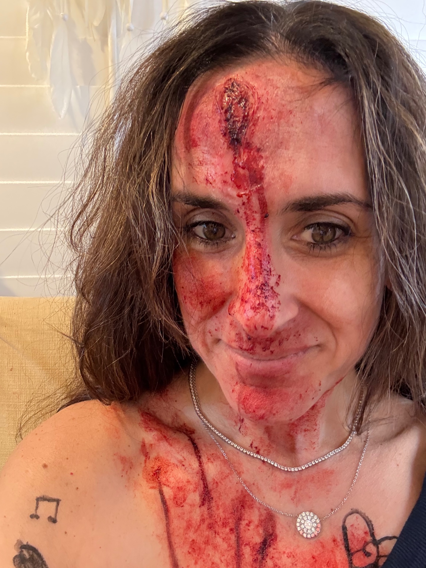 Arterial gore across face, neck, and chest