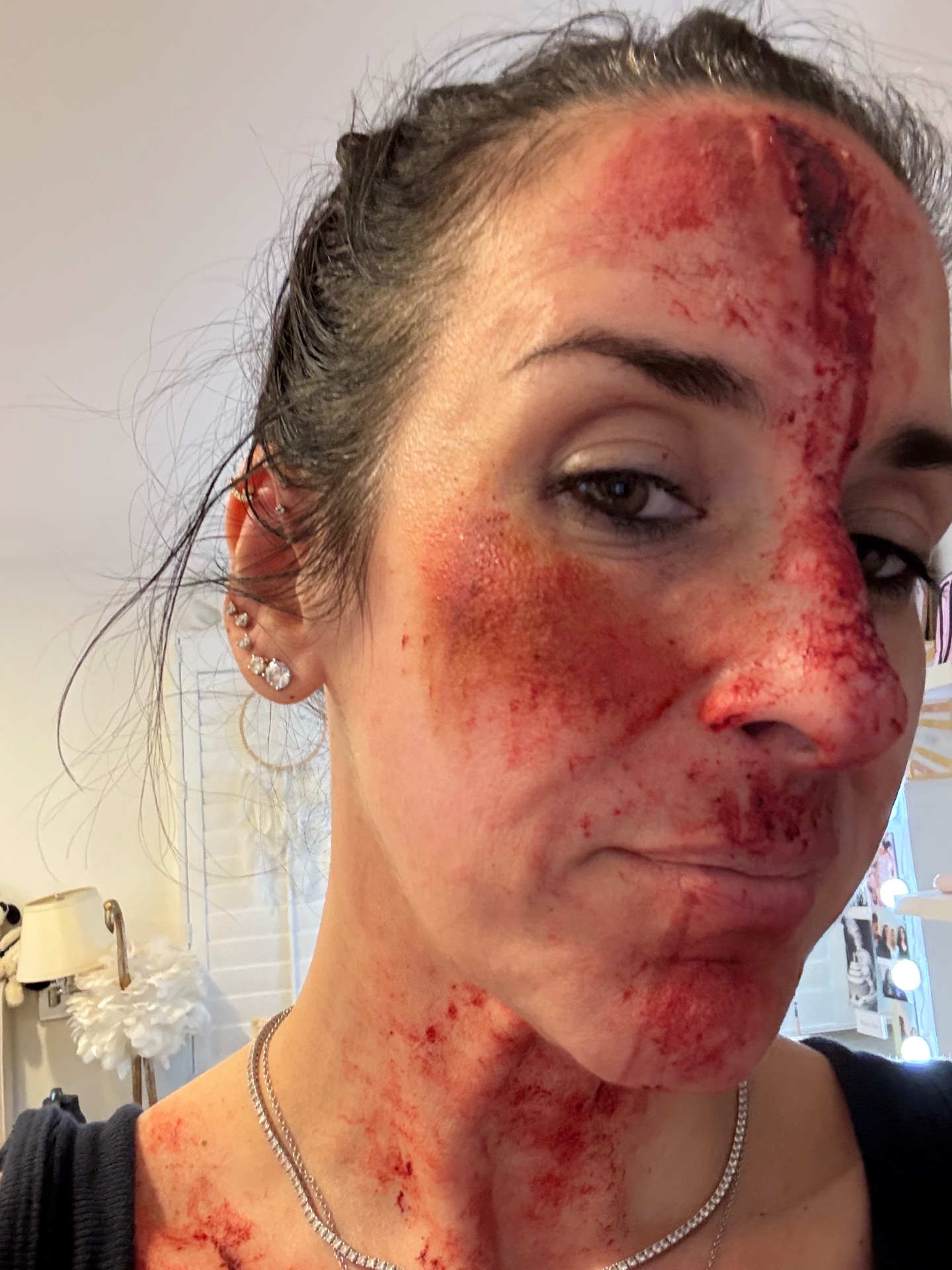 Bloodied face and neck character trauma